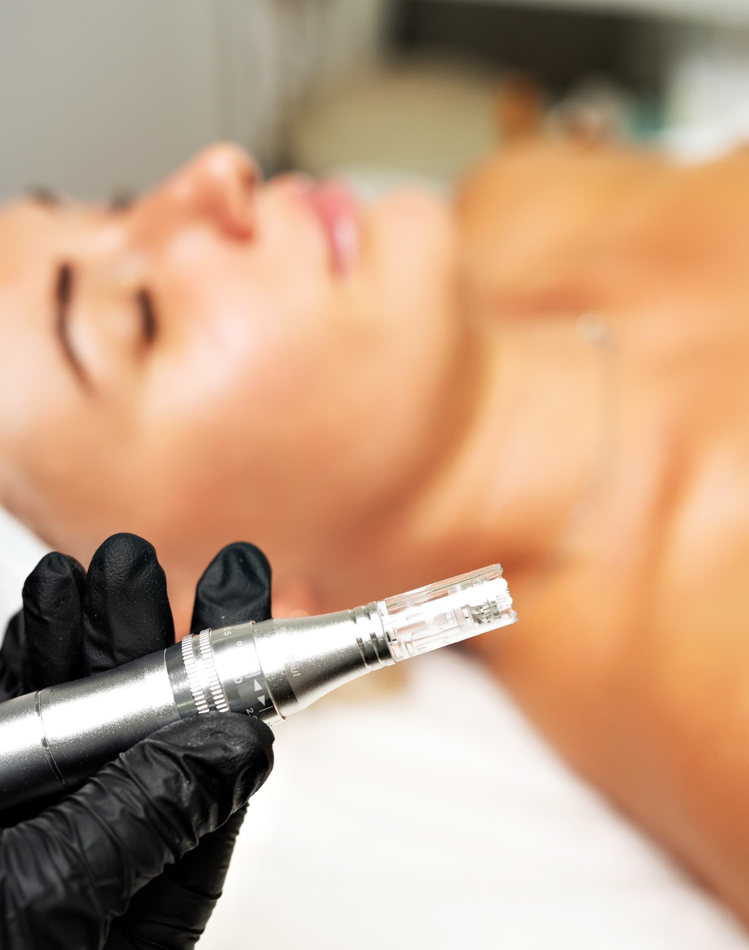 Microneedling-Handstück bei der Gesichtsbehandlung