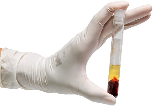 Behandschuhte Hand hält ein Röhrchen mit Eigenplasma
